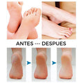 REMOVEDOR DE CALLOS Y EXFOLIANTE DE PIES