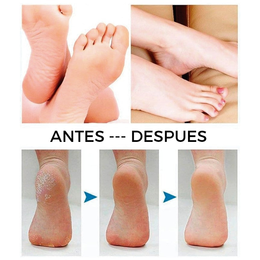 REMOVEDOR DE CALLOS Y EXFOLIANTE DE PIES