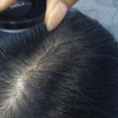 TAPA CANAS CAPILAR BUNEE