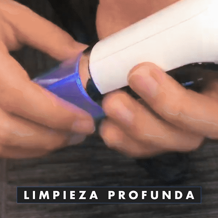 NUEVO REMOVEDOR DE ESPINILLAS ELÉCTRICO